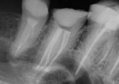 Endodoncja RTG Pulawy